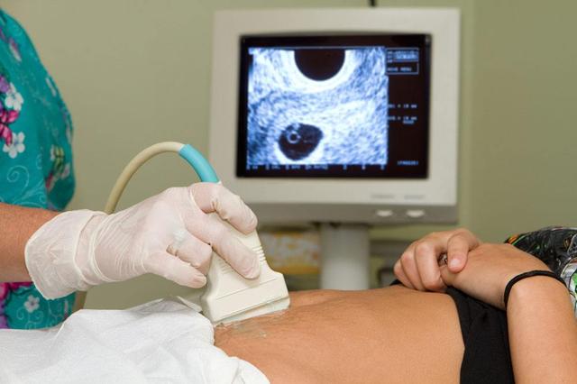 怀孕多久b超能看到胎心胎芽